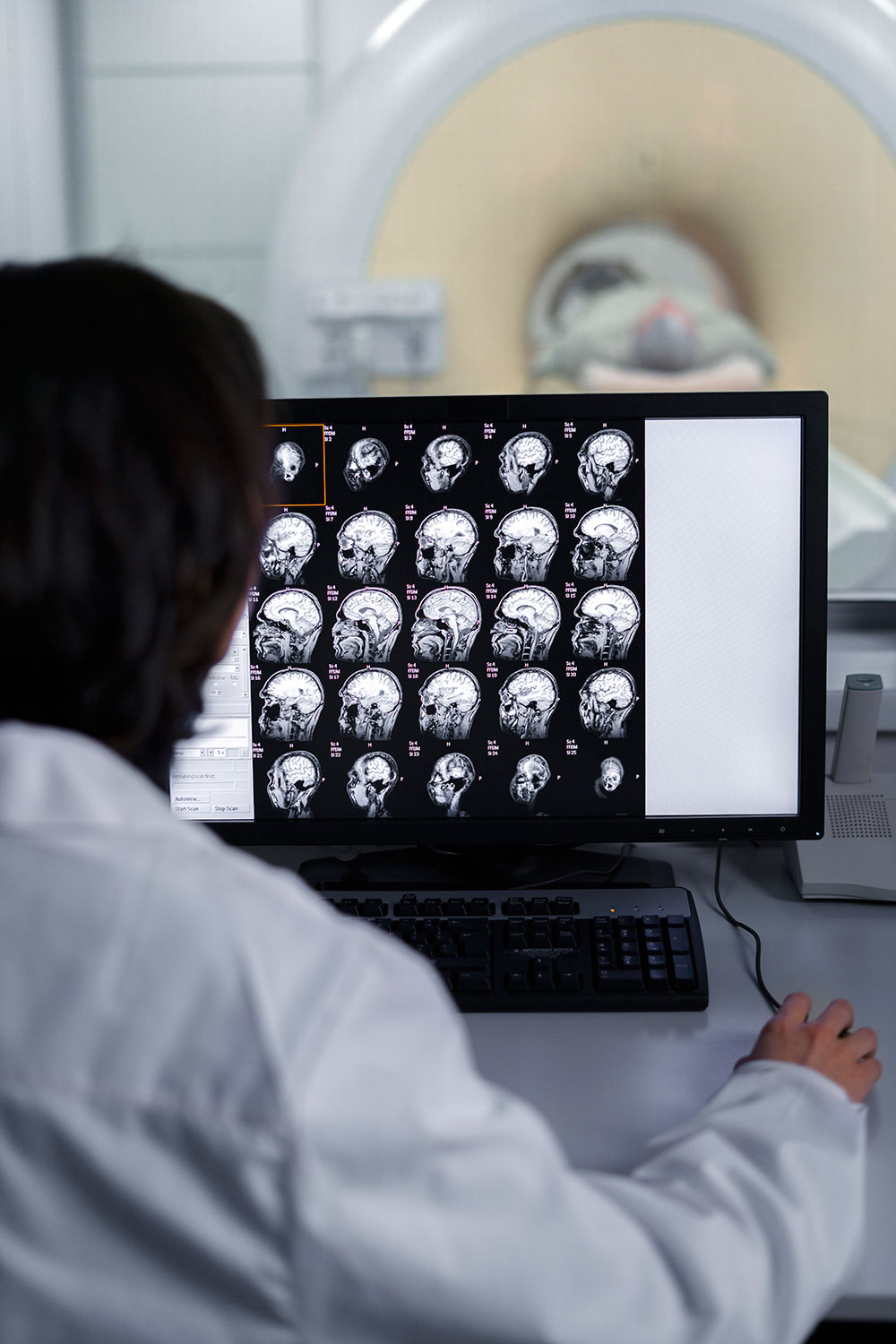 MRI Services